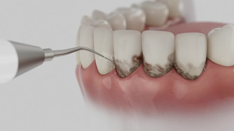Trusted Teeth Cleaning And Checkup service in Mineral Springs, AR - Dentist Open Now